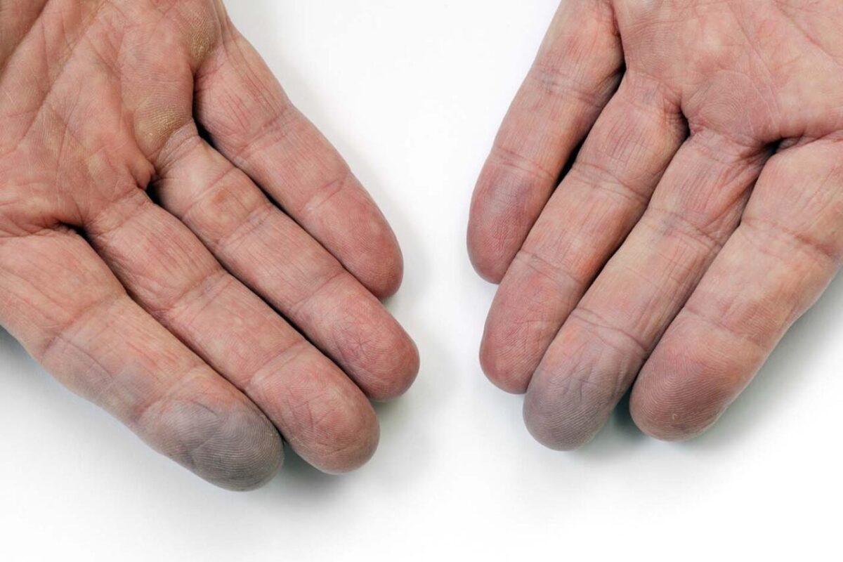 cold hands Born Fit 9 Possible Reasons for Cold Hands + Ways to Improve Blood Flow
